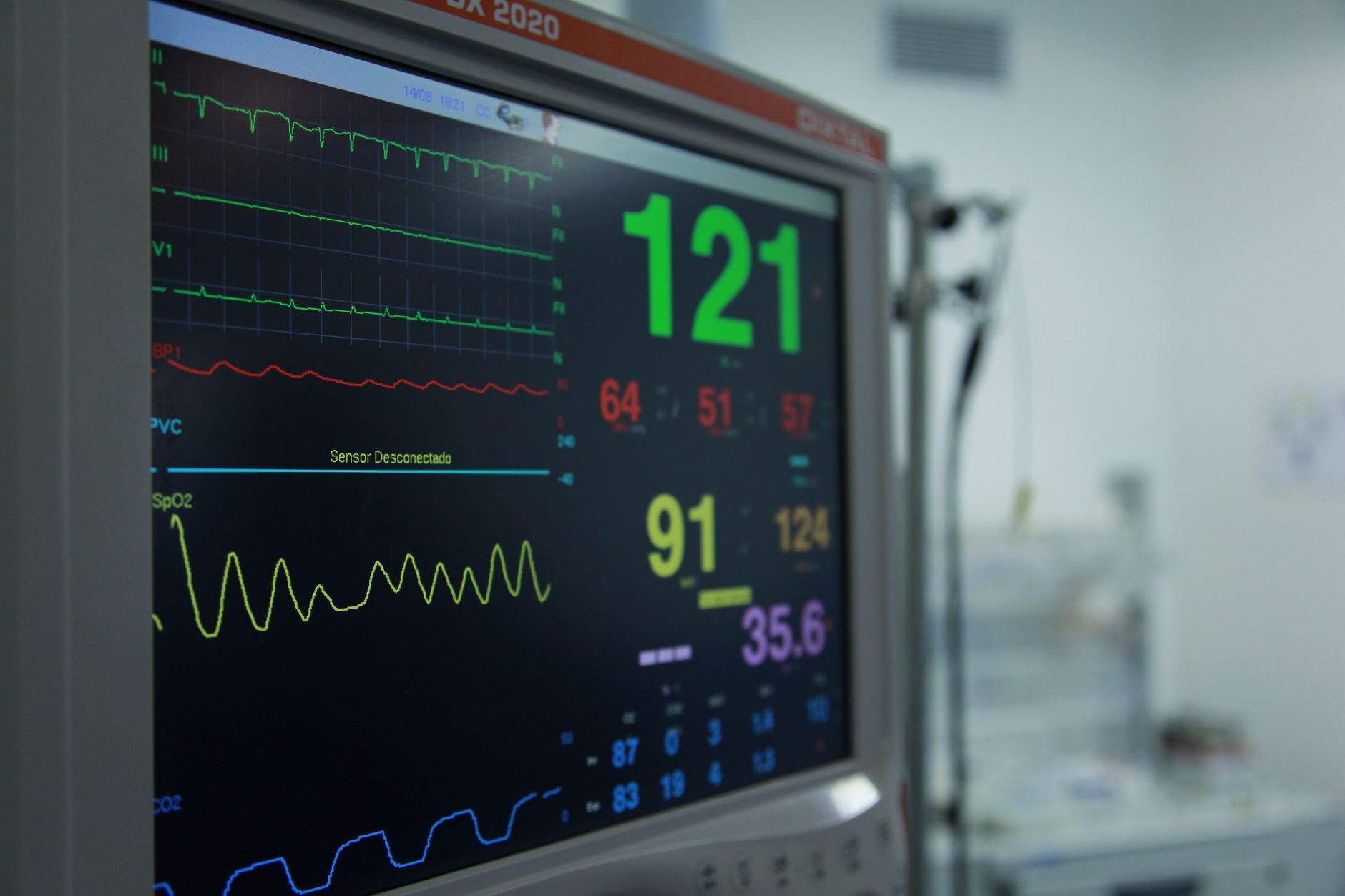 ECG heart monitor displaying cardiac rhythm in a hospital setting