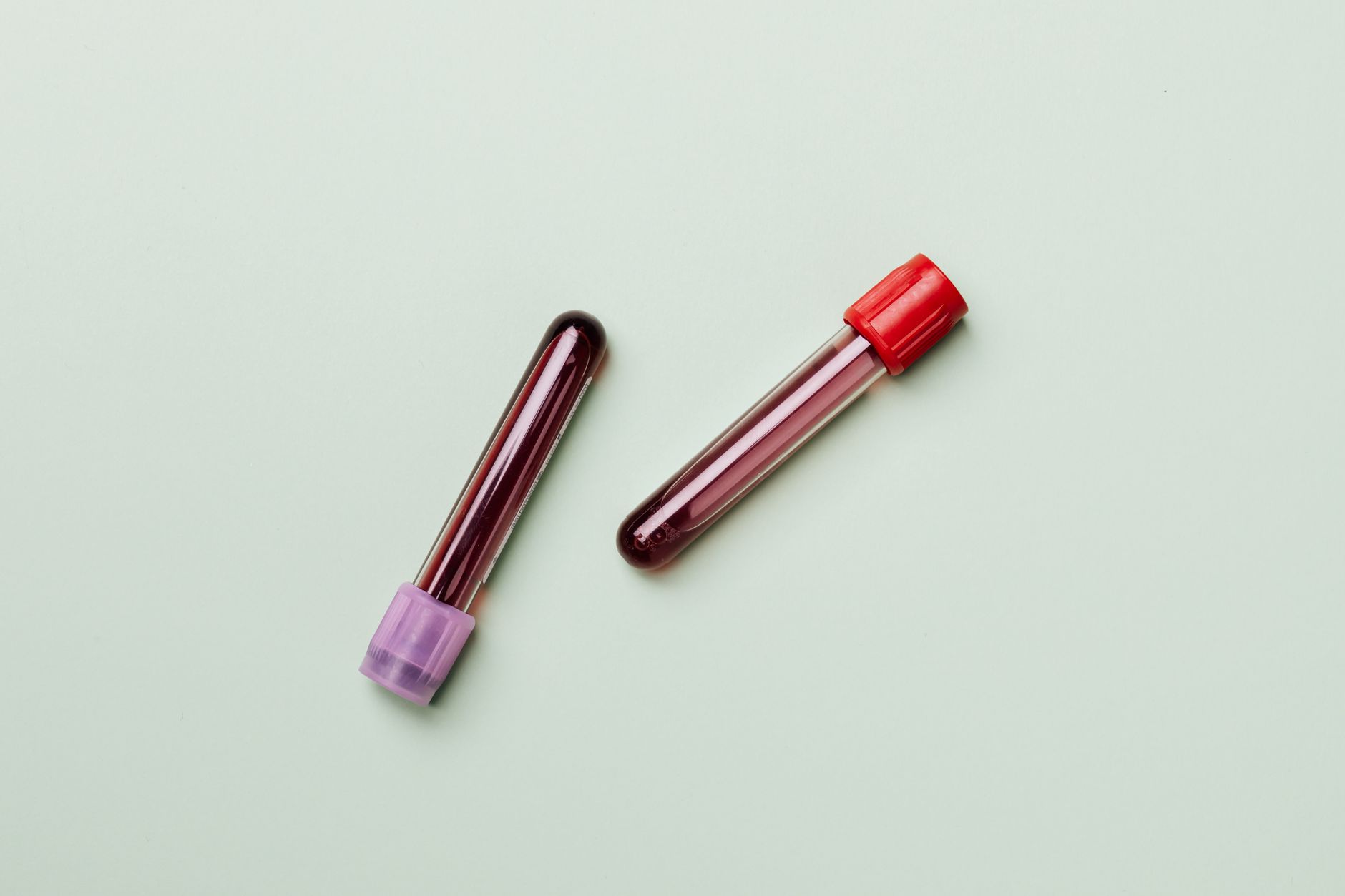 Blood sample tubes being prepared for laboratory analysis including hs-CRP testing