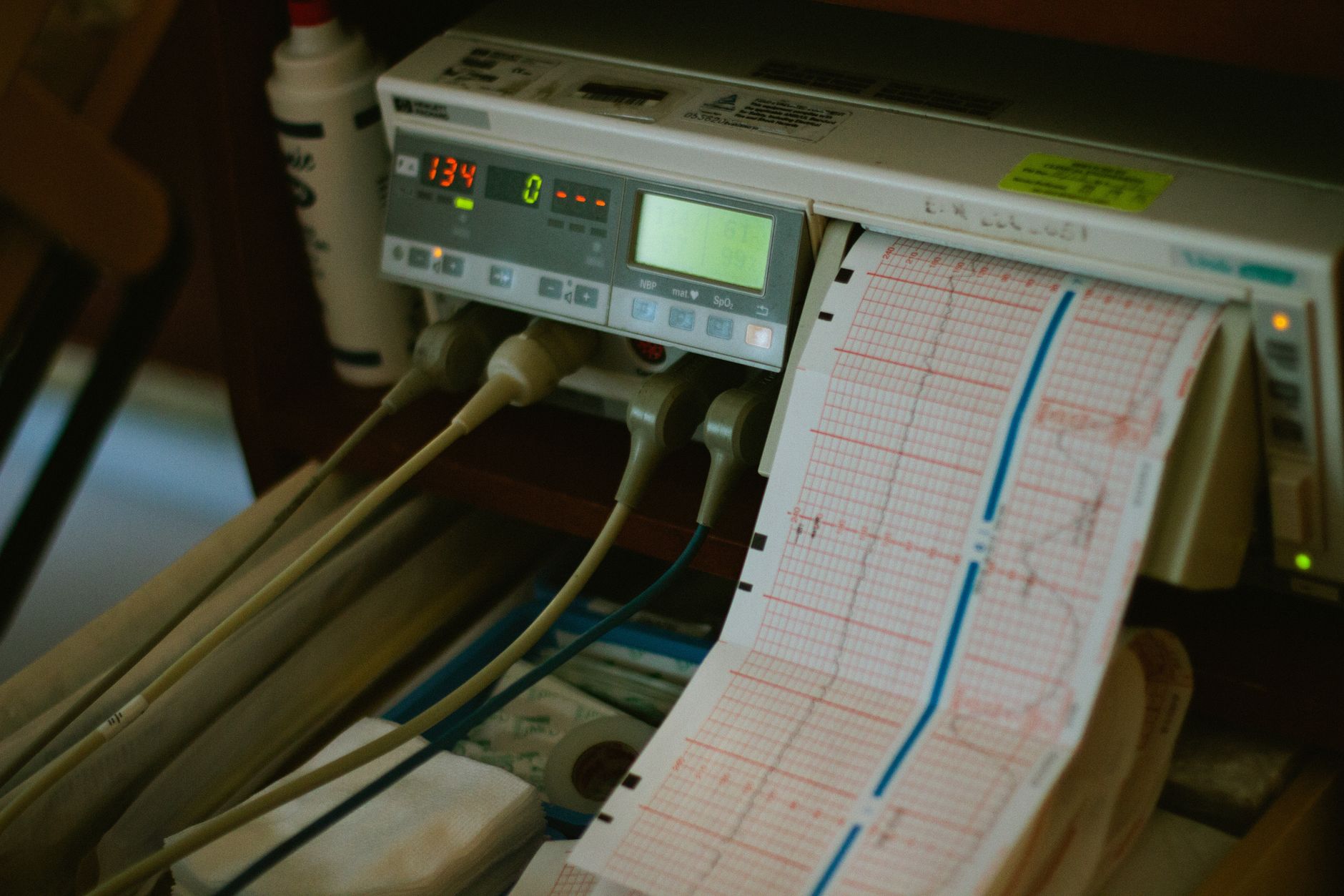An ECG heart monitor displaying cardiac activity in a hospital cardiology unit
