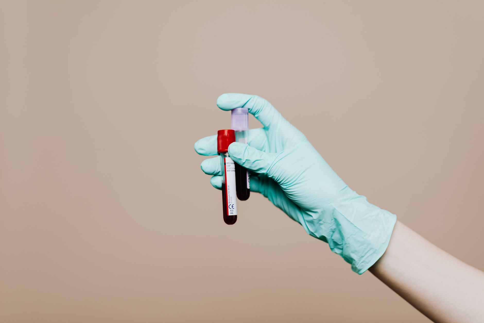 A healthcare professional collecting a blood sample for laboratory testing