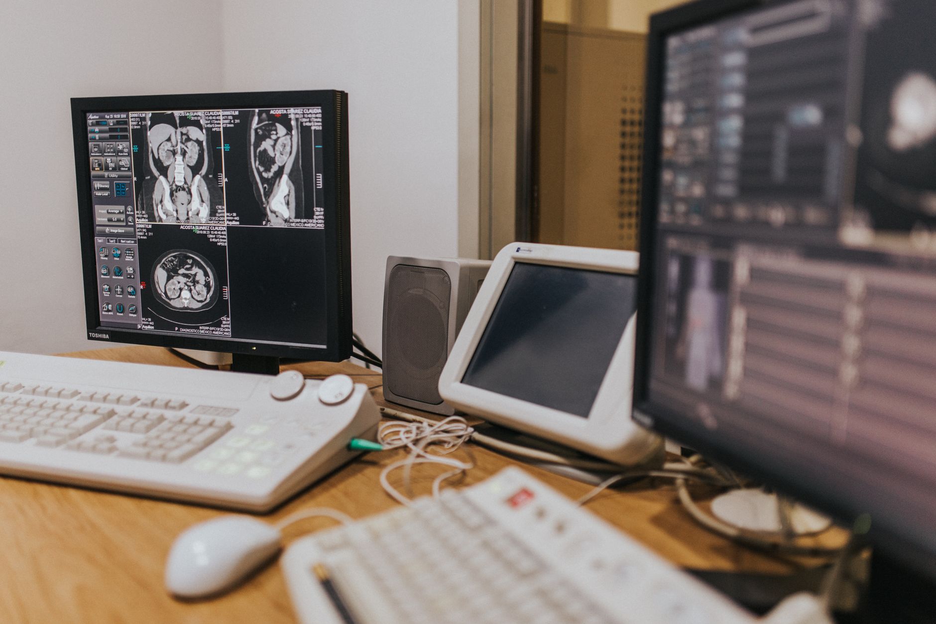 Cardiologist reviewing detailed coronary imaging on a monitor in the cath lab