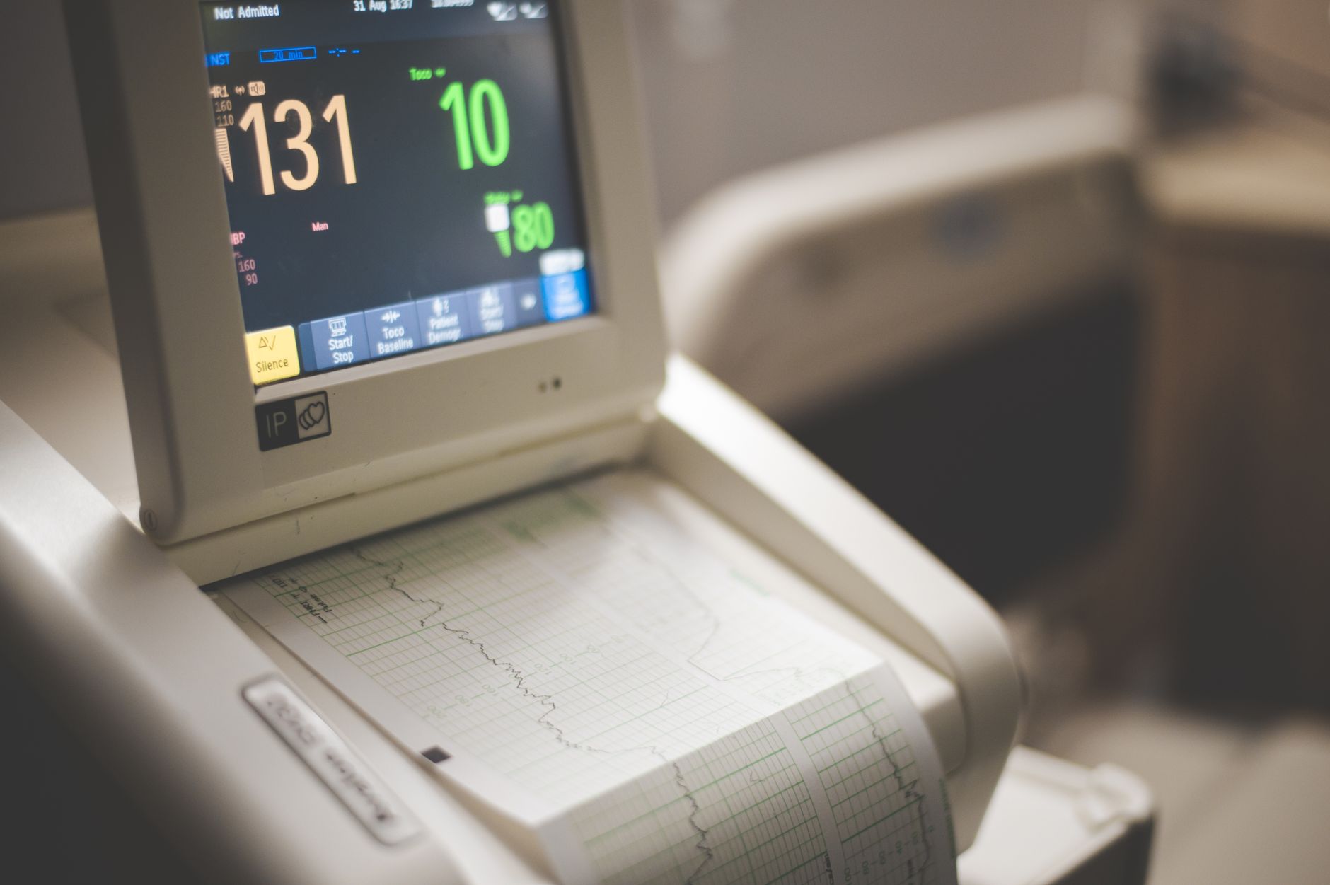 ECG heart monitor displaying readings in a hospital emergency setting