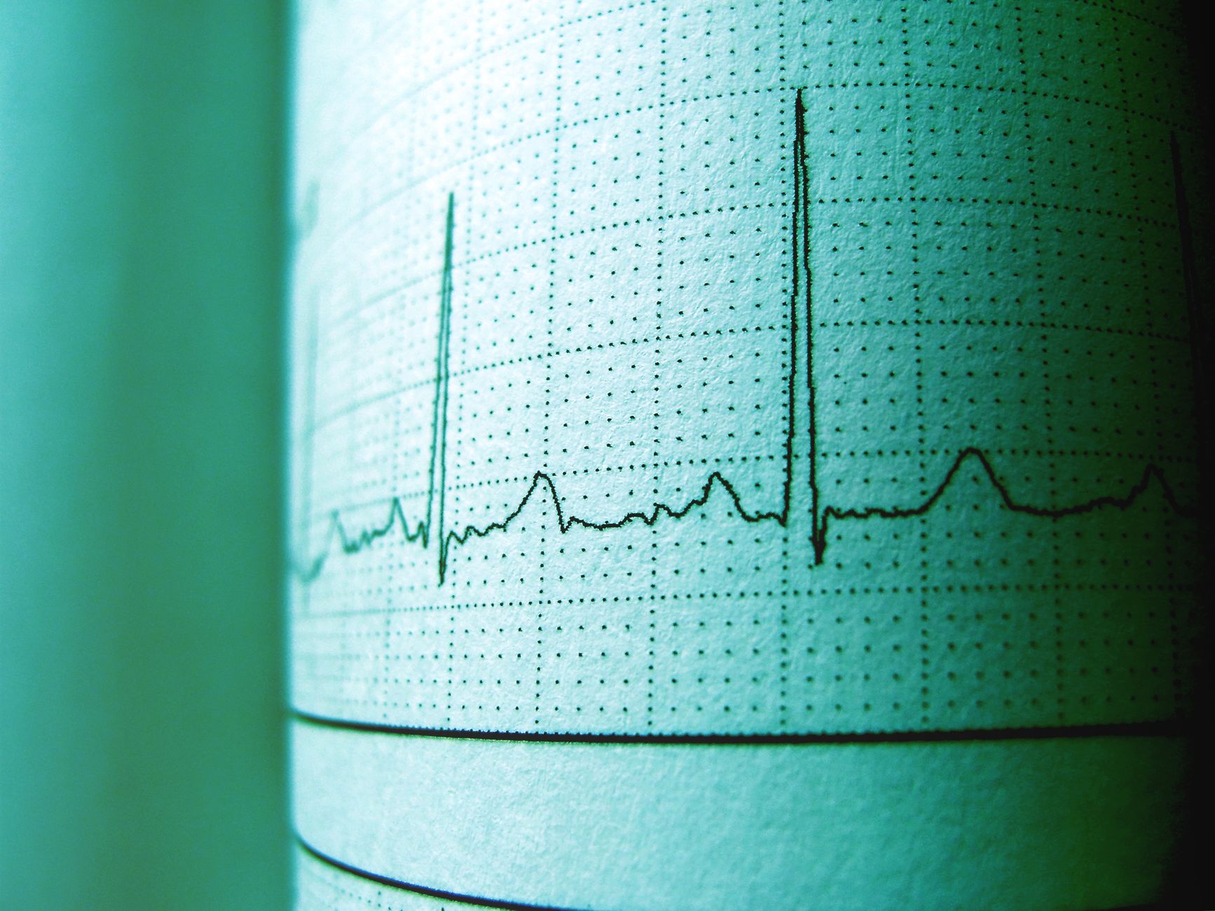 An ECG heart monitor displaying waveform readings in a medical clinic
