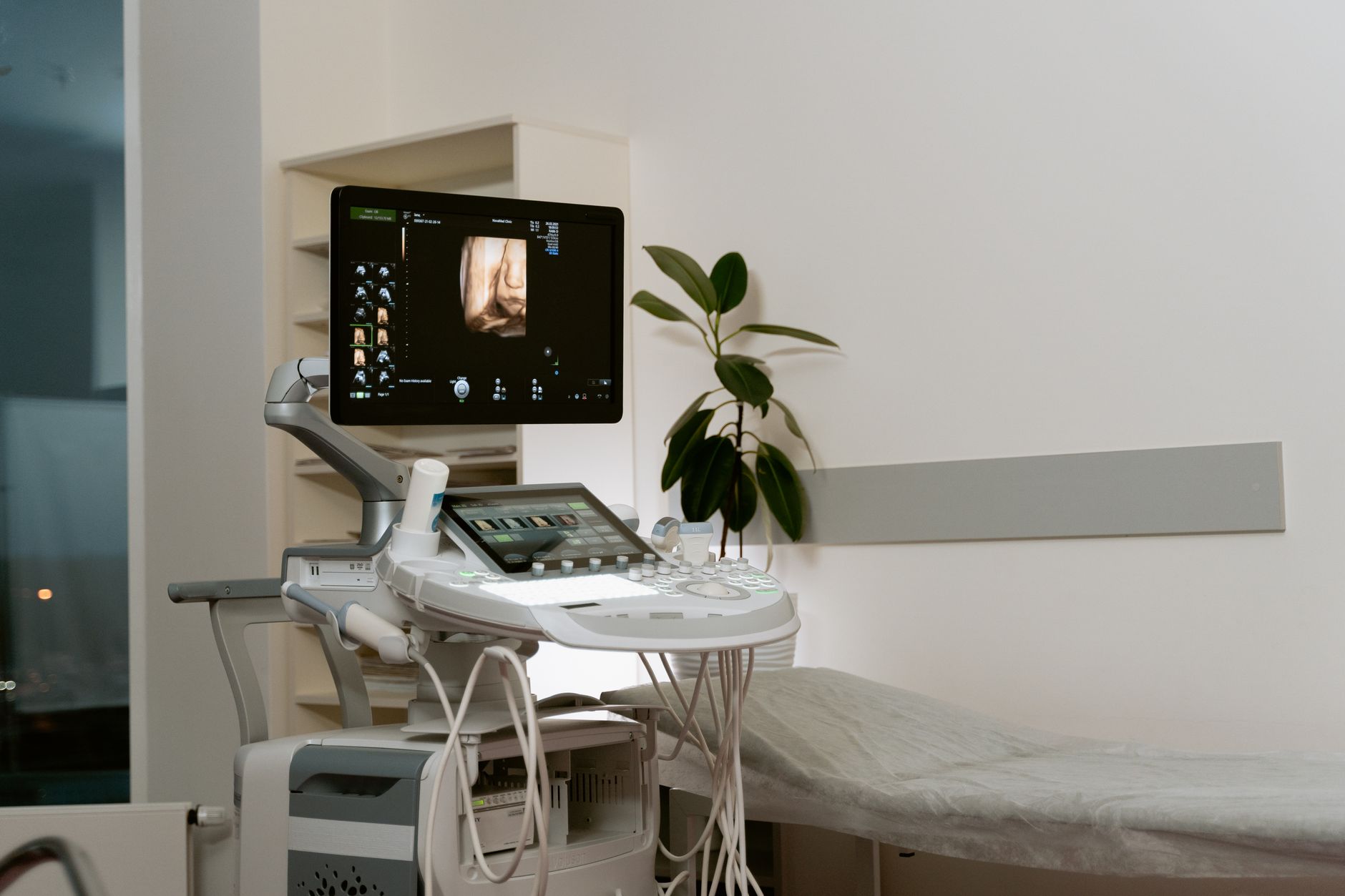 A healthcare professional performing an ultrasound scan on a patient's leg to check for vein conditions