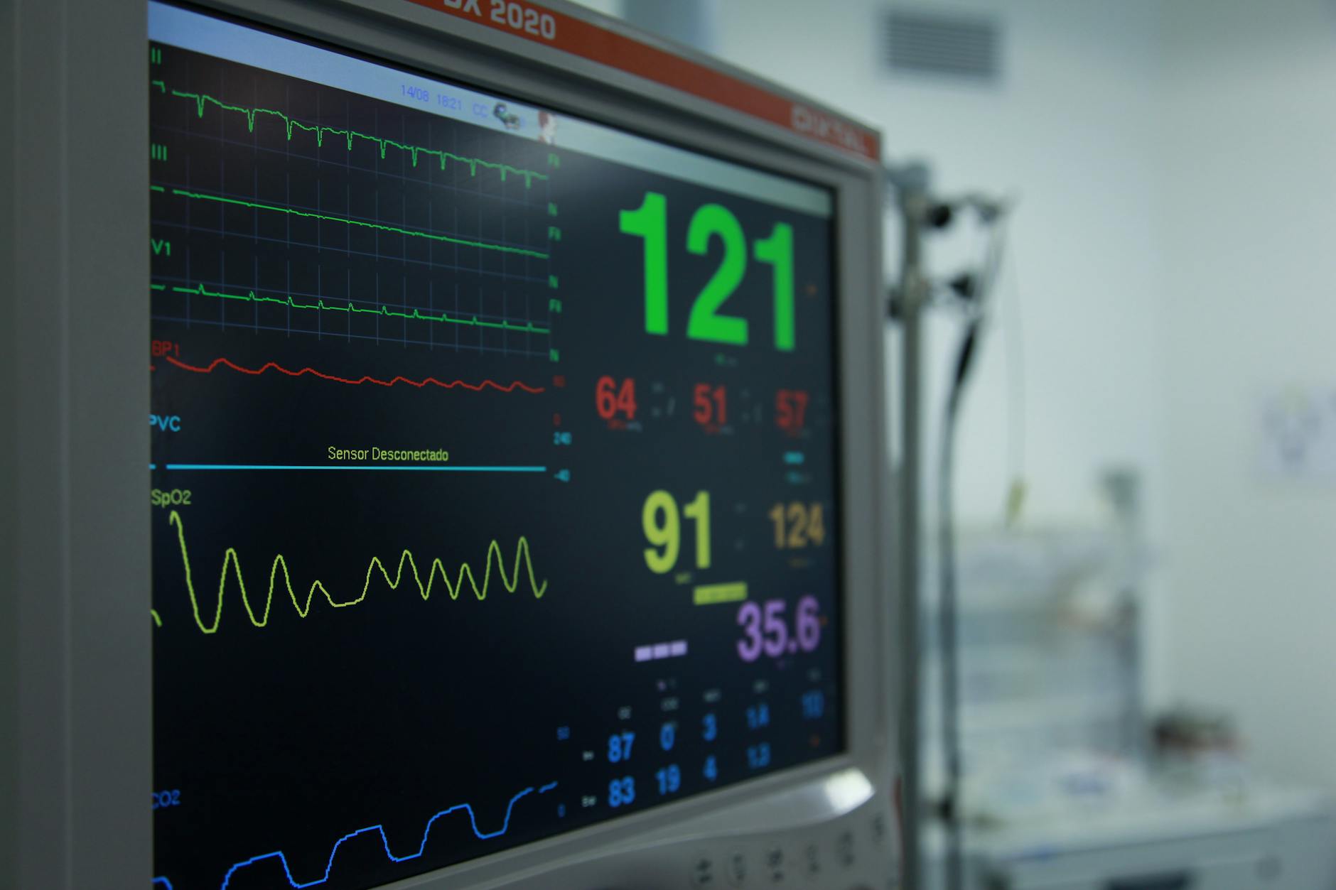 An ECG monitor displaying a heart rhythm waveform in a hospital setting
