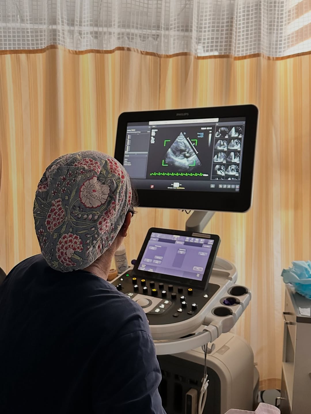 Dobutamine Stress Echo: A Heart Test for Patients Who Cannot Use a Treadmill — image 1