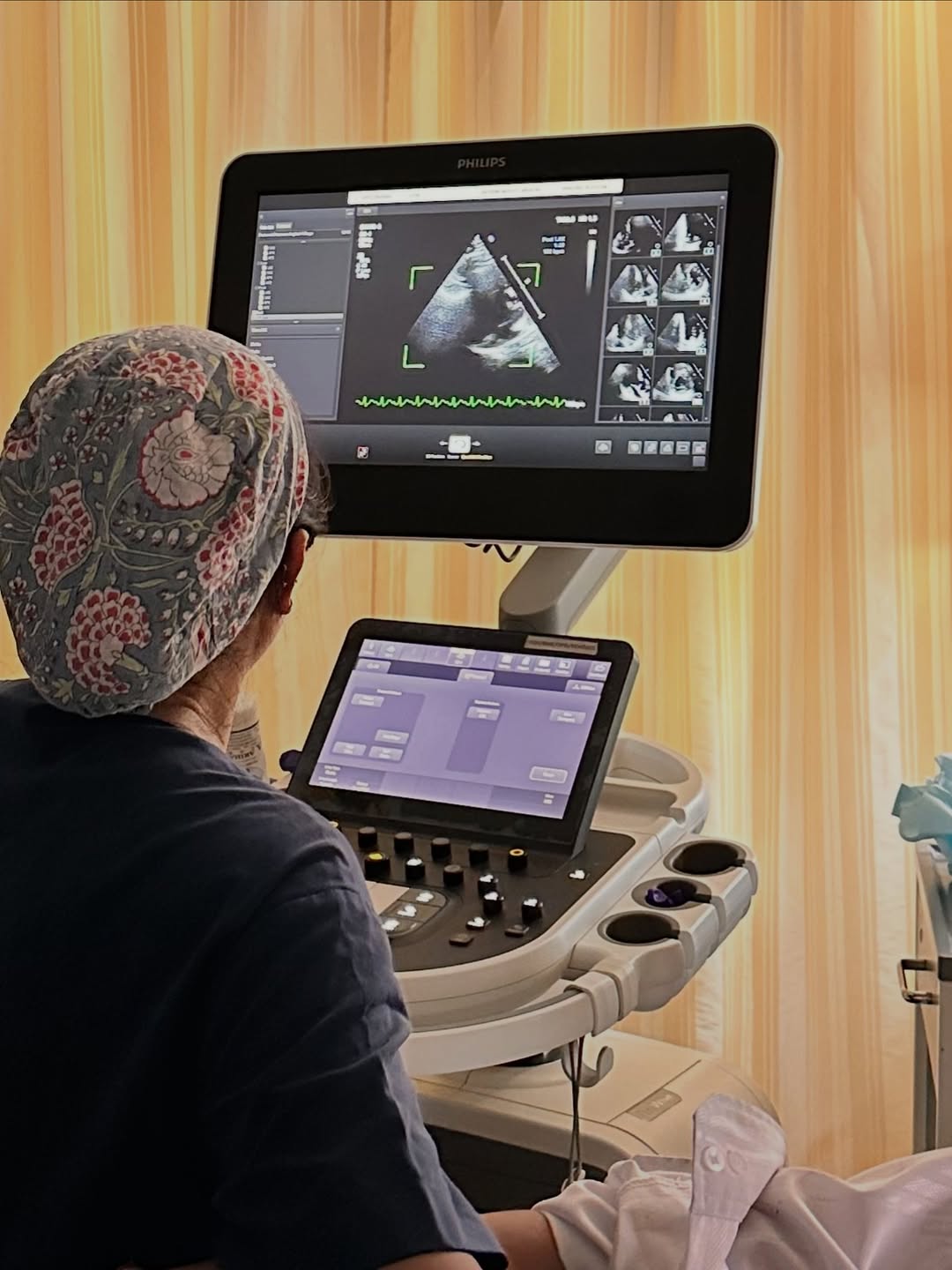 Dobutamine Stress Echo: A Heart Test for Patients Who Cannot Use a Treadmill — image 2
