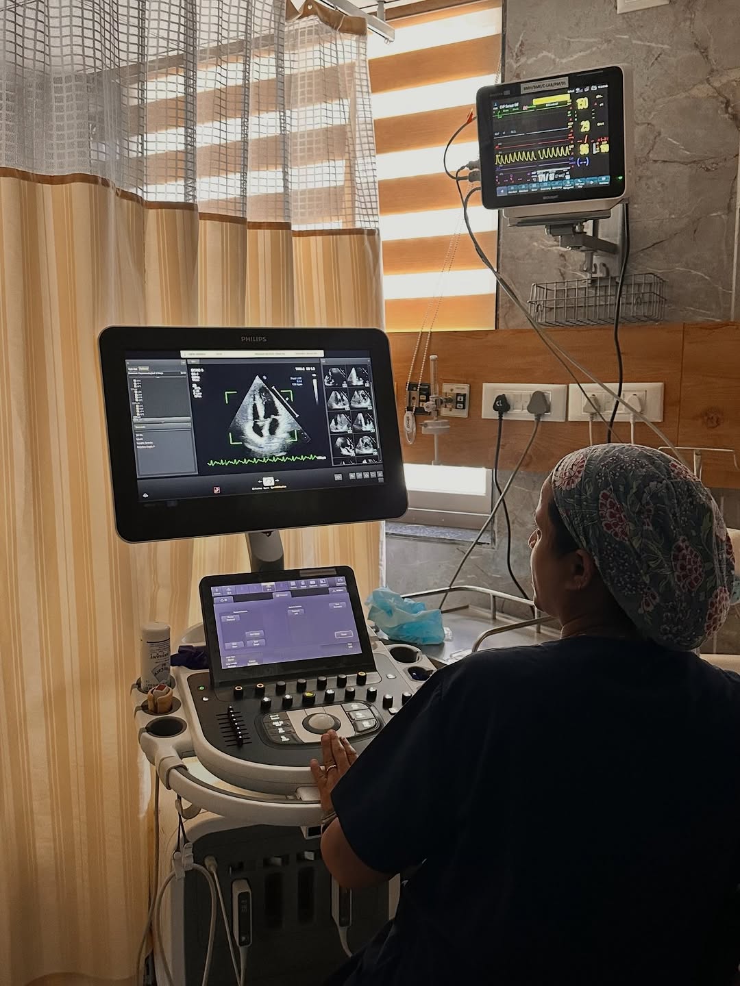 Dobutamine Stress Echo: A Heart Test for Patients Who Cannot Use a Treadmill — image 3